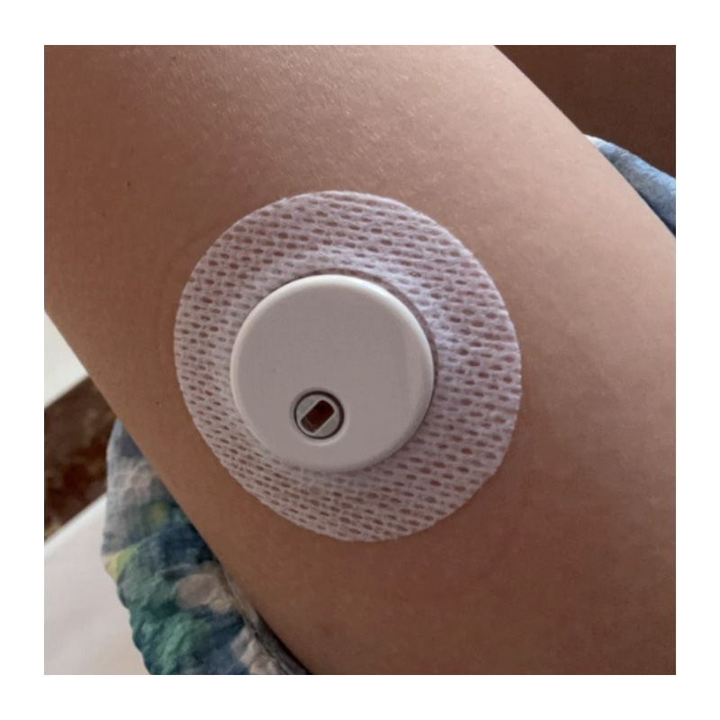 오리지널 린크스 센서 패치 CGM 스티커 의료용 접착  - Medical X 리뷰 및 가격